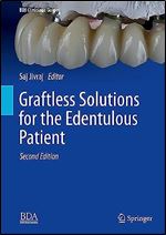 Graftless Solutions for the Edentulous Patient (BDJ Clinician s Guides) Ed 2