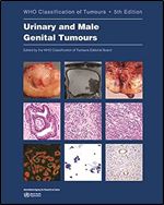 Urinary and Male Genital Tumours (WHO Classification of Tumours, 8) Ed 5