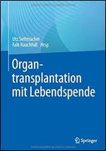 Organtransplantation mit Lebendspende (German Edition)