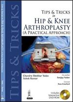 Tips and Tricks in Hip and Knee Arthroplasty: (A Practical Approach) (Tips & Tricks)