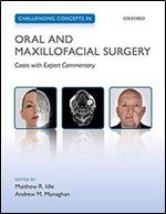 Challenging Concepts in Oral and Maxillofacial Surgery: Cases with Expert Commentary (Challenging Cases)