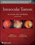 Intraocular Tumors: An Atlas and Textbook (Volume 1)