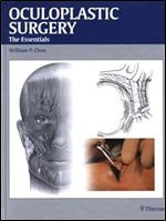 Oculoplastic Surgery: The Essentials