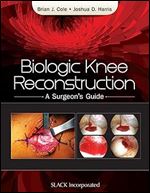 Biologic Knee Reconstruction: A Surgeon's Guide