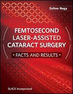 Femtosecond Laser-Assisted Cataract Surgery: Facts and Results
