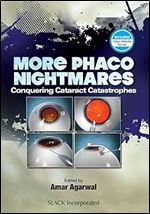 More Phaco Nightmares: Conquering Cataract Catastrophes