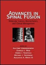 Advances in Spinal Fusion: Molecular Science, BioMechanics, and Clinical Management