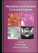 Hereditary and Familial Colorectal Cancer