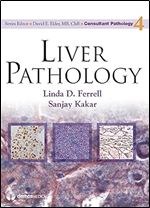Liver Pathology (Consultant Pathology, Volume 4)