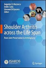 Shoulder Arthritis across the Life Span: From Joint Preservation to Arthroplasty