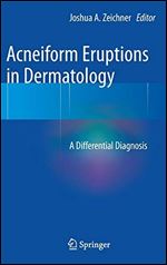 Acneiform Eruptions in Dermatology: A Differential Diagnosis