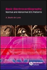 Basic Electrocardiography: Normal and Abnormal ECG Patterns (Blackwell's At a Glance Series)