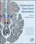 Connectomic Deep Brain Stimulation