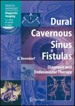 Dural Cavernous Sinus Fistulas: Diagnosis and Endovascular Therapy