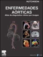 ENFERMEDADES AORTICAS: Atlas de diagnostico cIinico por imagen (spanish)