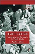 Hearts Exposed: Transplants and the Media in 1960s Britain