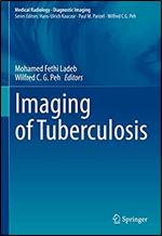 Imaging of Tuberculosis (Medical Radiology)
