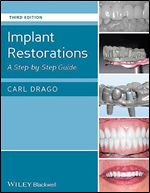 Implant Restorations: A Step-by-Step Guide Ed 3