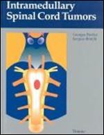 Intramedullary Spinal Cord Tumors (Thieme)