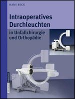 Intraoperatives Durchleuchten in Unfallchirurgie und Orthopadie (German Edition)
