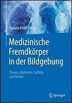 Medizinische Fremdkorper in der Bildgebung: Thorax, Abdomen, Gefae und Kinder [German]