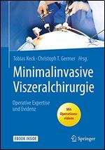 Minimalinvasive Viszeralchirurgie: Operative Expertise und Evidenz [German]
