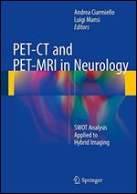 PET-CT and PET-MRI in Neurology: SWOT Analysis Applied to Hybrid Imaging