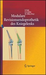 Revisionsendoprothetik des Kniegelenks (German Edition)