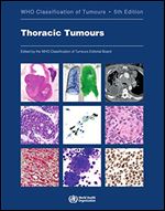 Thoracic Tumours: WHO Classification of Tumours Ed 5