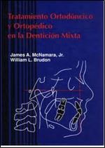 Tratamiento Ortodontico Y Ortopedico En La Denticion mixta (Spanish Edition)