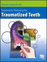 Treatment Planning for Traumatized Teeth