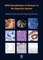 WHO Classification of Tumours of the Digestive System [OP]