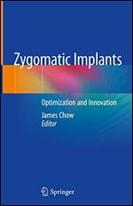 Zygomatic Implants: Optimization and Innovation